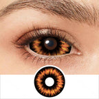 Radioactive Sclera Contacts